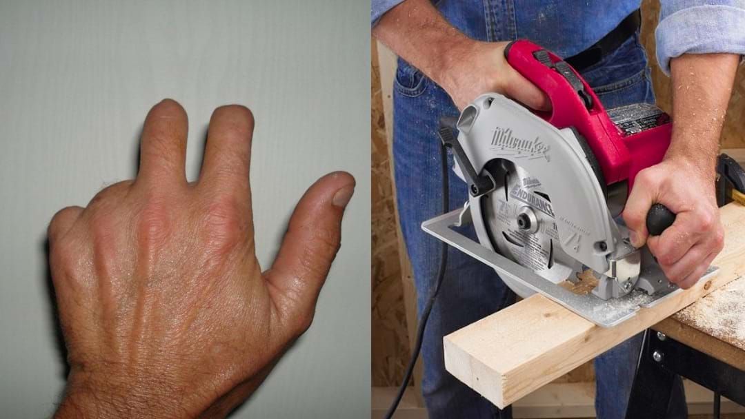 Article heading image for Ash's Partner 'Pistol Pete' Sliced His Fingers Off With A Circular Saw