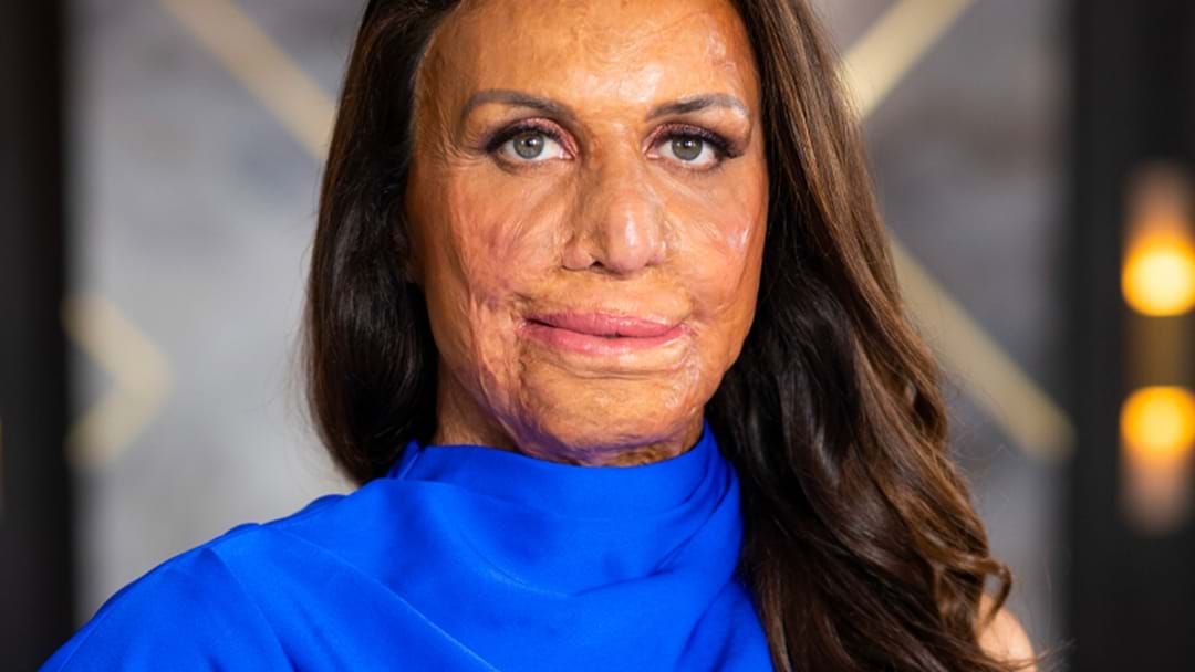 Article heading image for UNCUT: Turia Pitt Opens Up On THAT Rivalry With Ronnie