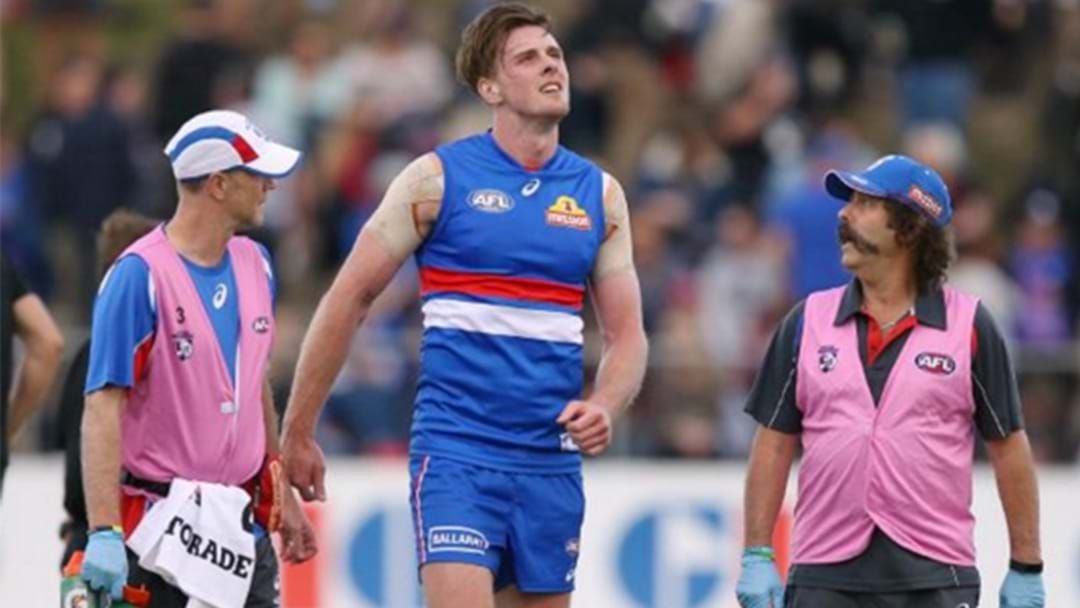 Article heading image for Bulldogs Confirm Extent Of Roughead's Injury