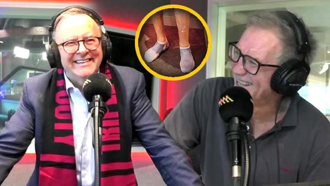 Article heading image for Rough! | Prime Minister Anthony Albanese Gives Marto A Hard Time About His Socks!