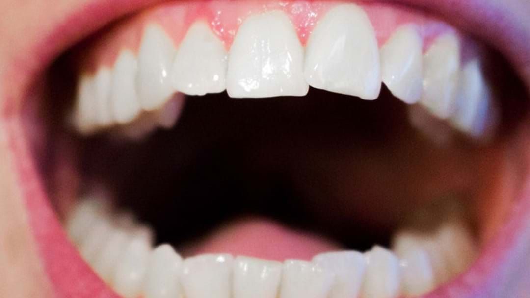 Article heading image for Millions Of Aussies Missing Teeth Due To Sugar Rotting 