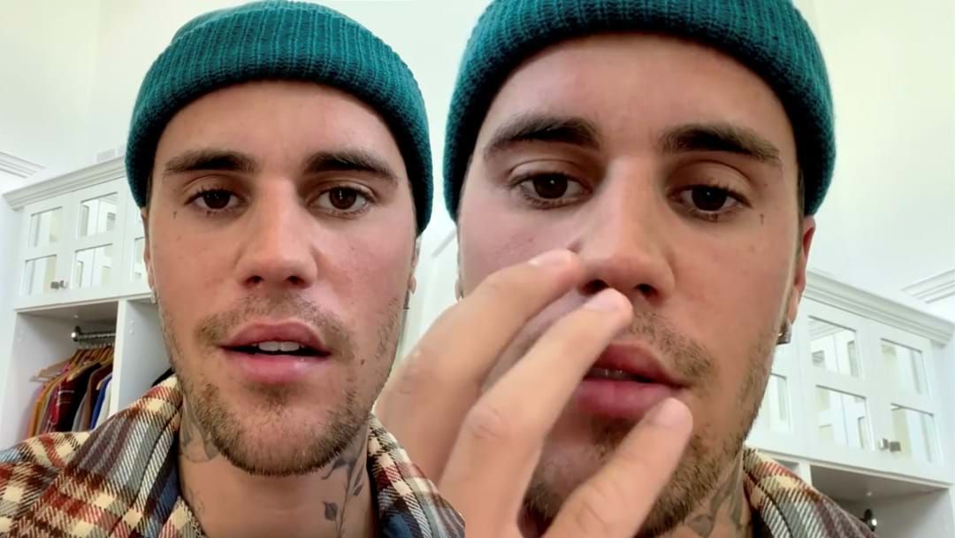 Article heading image for Justin Bieber Reveals One Half Of His Face Is Paralysed