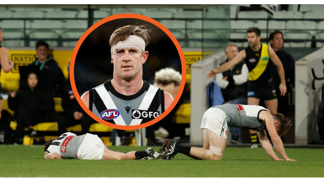 Article heading image for Tom Jonas On Head Clash With Zak Butters In Last Night’s Richmond Vs Port Adelaide Game
