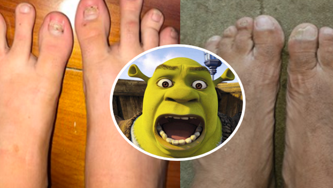 Article heading image for Be Brave And Look At All Of Our Townsville's Ugliest Foot Entries