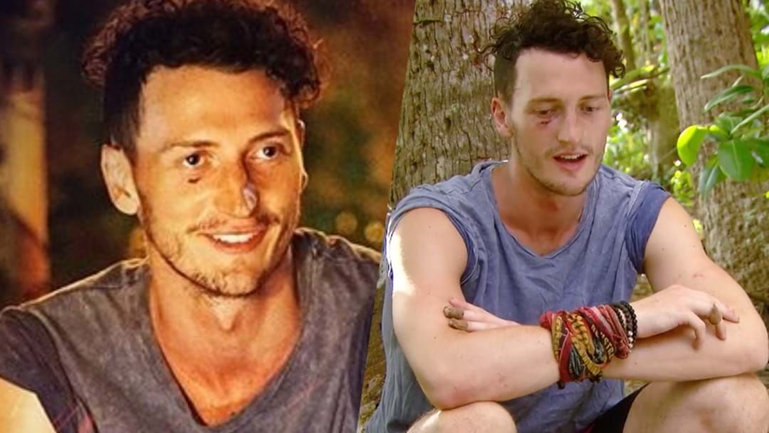 Article heading image for This Is How Survivor's Benji Got That Mysterious Cut On His Face