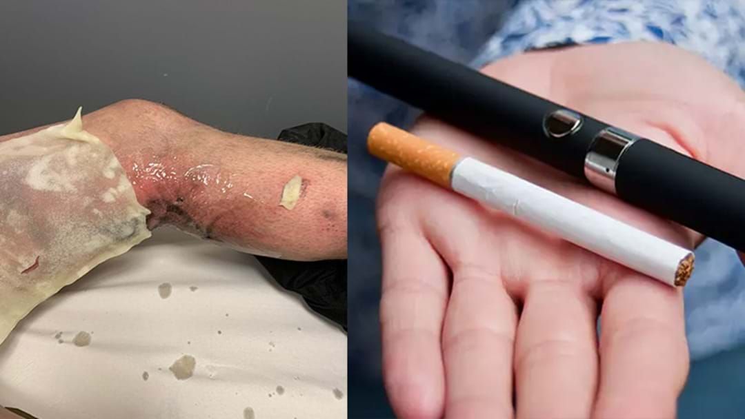 Article heading image for Bloke Nearly Had His Jewels Blown Off After E-Cigarette Exploded