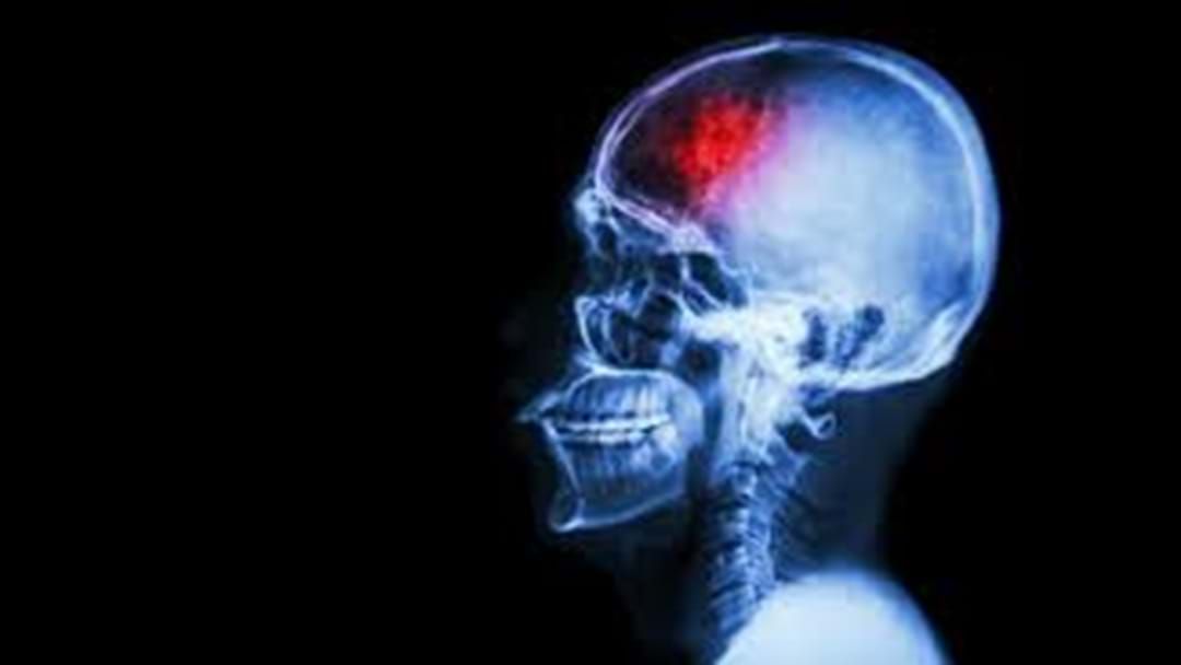 Article heading image for Toowoomba Residents More at Risk Suffering from a Stroke