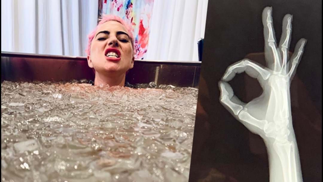 Article heading image for Lady Gaga Has Entire Body X-Rayed After Nasty Stage Fall