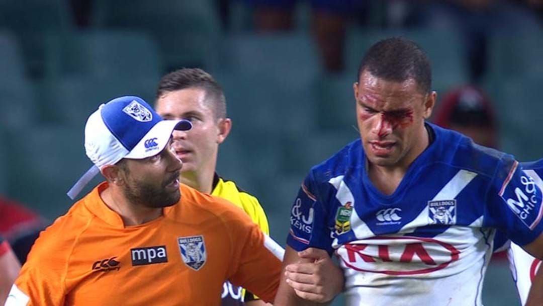 Article heading image for Update On Hopoate's Injury