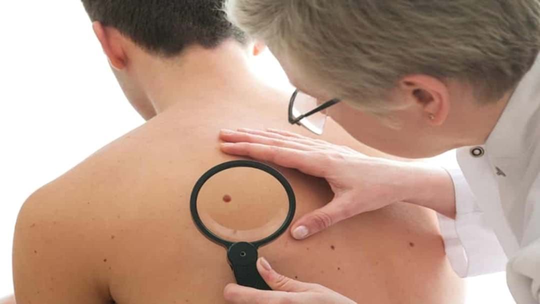 Article heading image for SA Researchers Discover Breakthrough Treatment To Stop Aggressive Melanoma 
