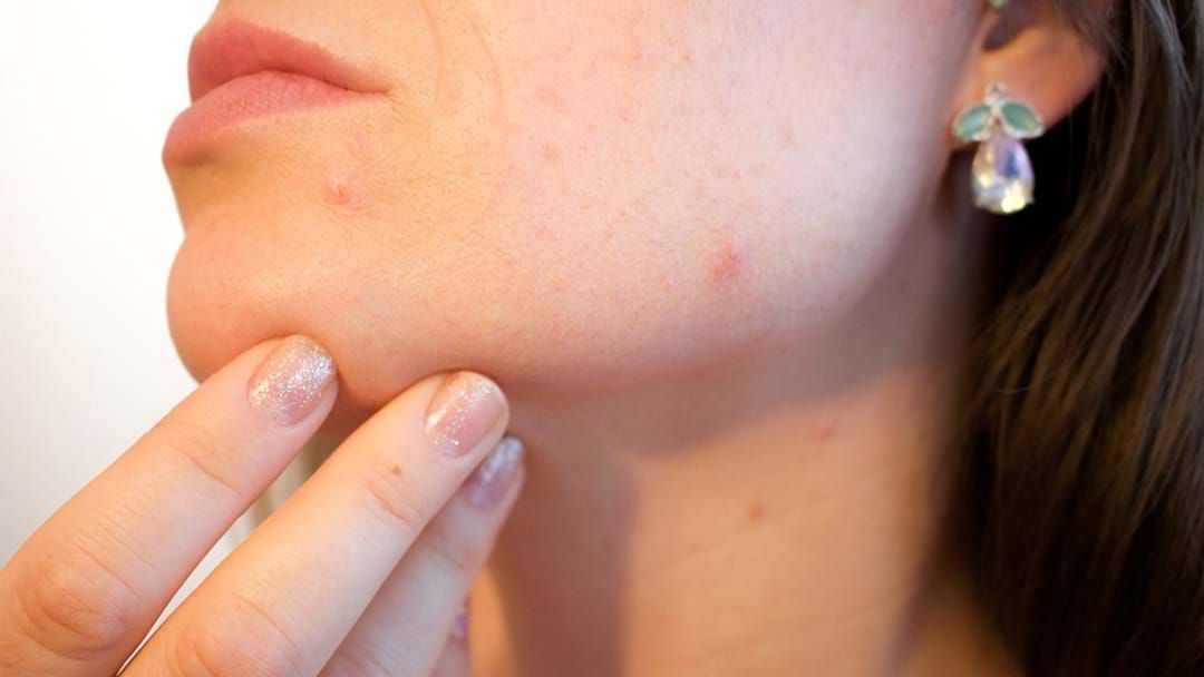 Article heading image for Why You May Be Hooked On Pimple-Popping Videos