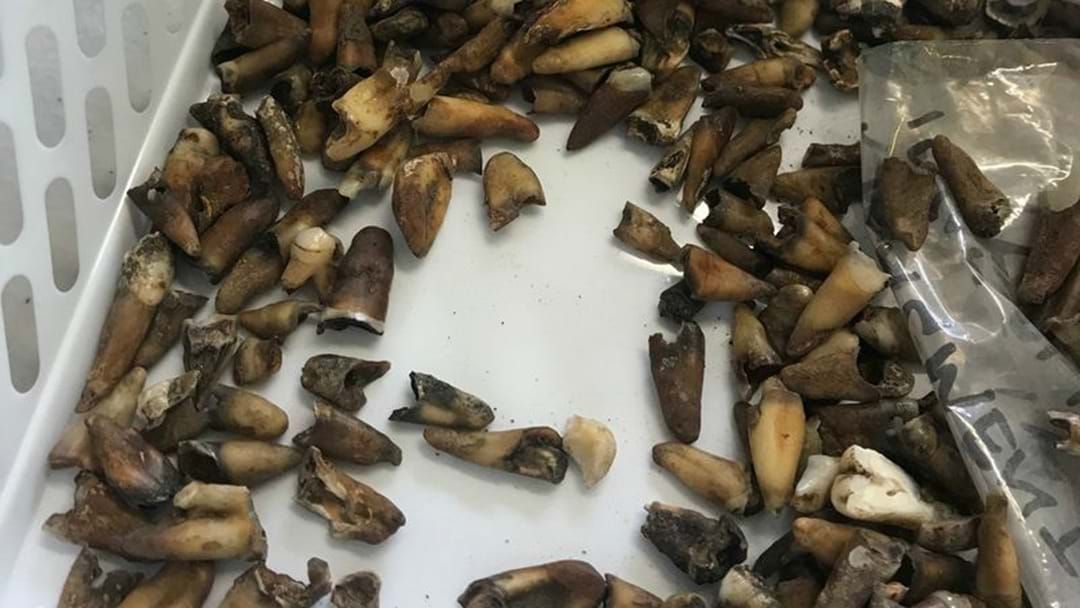 Article heading image for Thousands Of Human Teeth Have Been Found Underneath The Melbourne CBD 