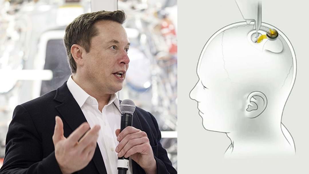 Article heading image for Expert Explains Elon Musk's Neuralink & It's WILD Mind Reading Powers