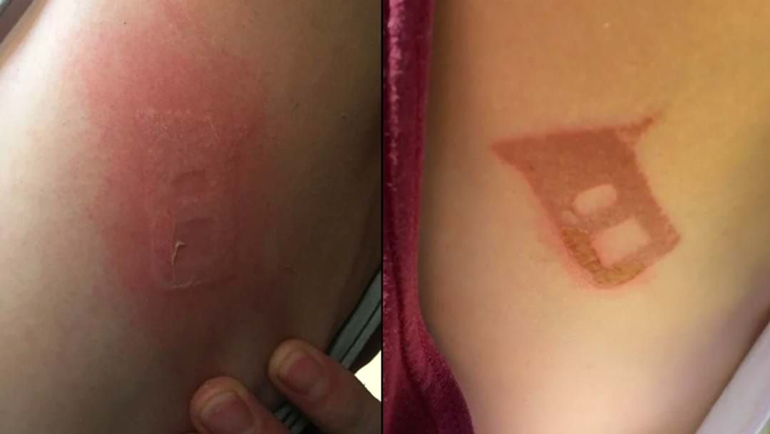 Article heading image for One Aussie Bloke Got Branded By His Seat Belt During A 45-Degree Day Last Week