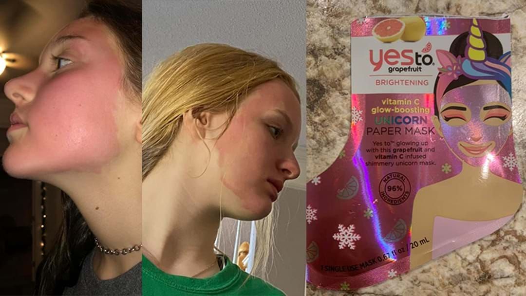 Article heading image for A Popular Skincare Brand Has Pulled Face Masks Off Shelves After Causing Burns