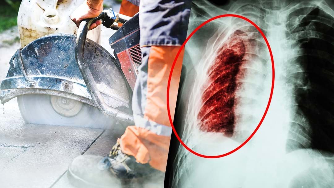 Article heading image for The Disease Killing Sydney Tradies: over 500,000 Aussies at risk every day