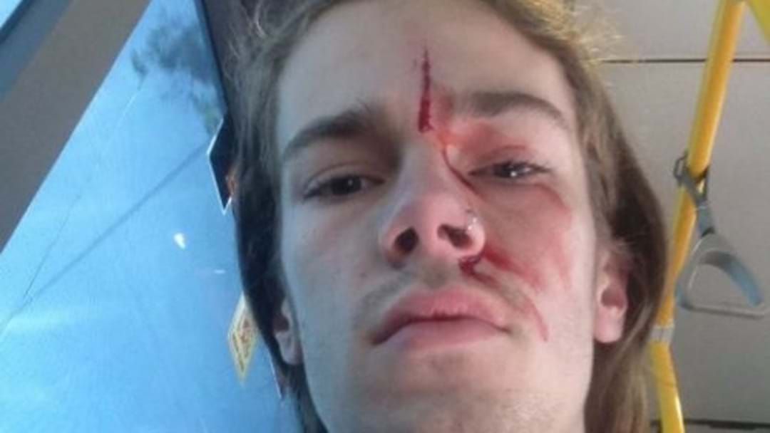 Article heading image for Kevin Rudd Says His Godson Got Punched Over Gay Marriage Views