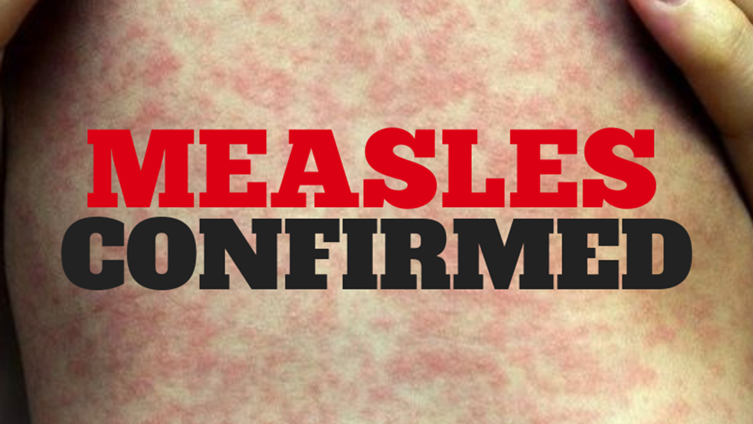 Article heading image for Four Measles Cases Confirmed on Coffs Coast