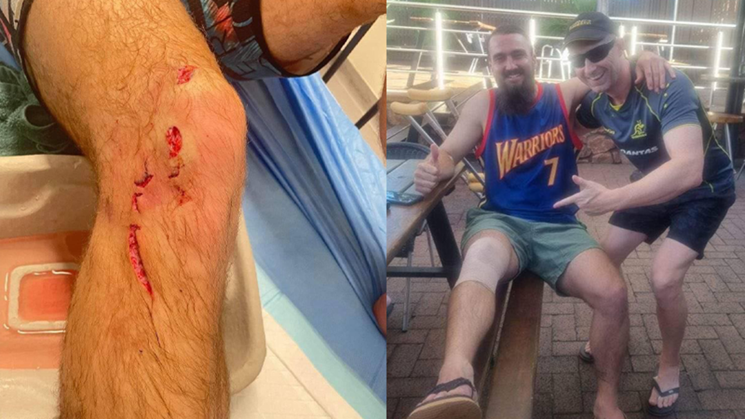 Article heading image for WA Man Heads To Pub After Being Attacked By A 2m Crocodile