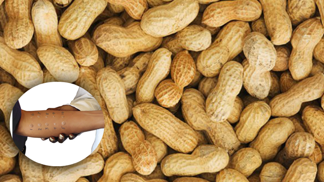 Article heading image for Calls For Mandatory Peanut Allergy Tests Before High School