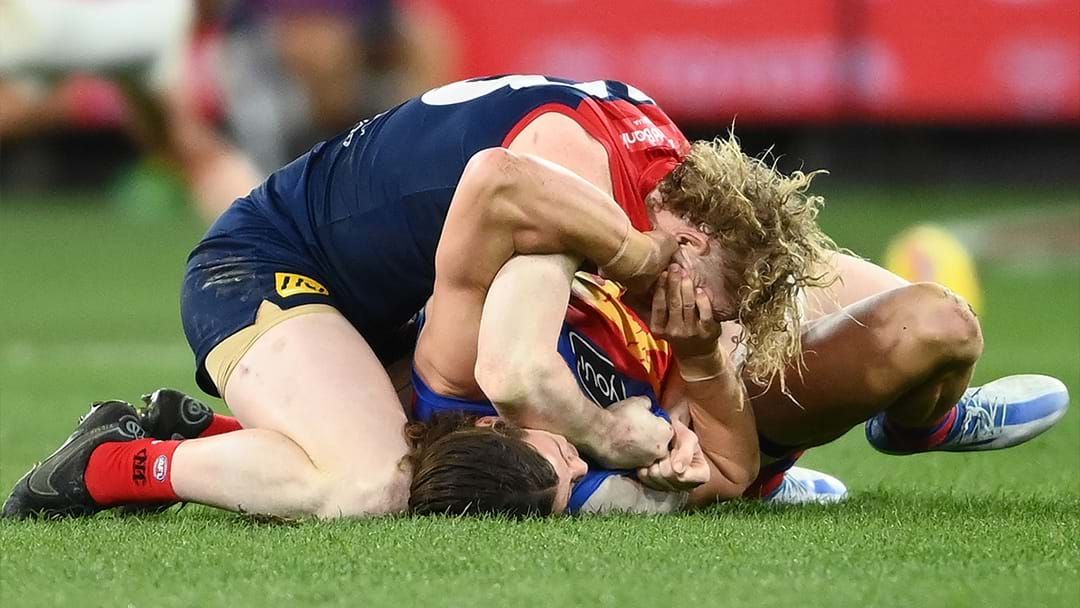 Article heading image for Discussing The Case Of Jarrod Berry's Alleged Eye Gouge Incident